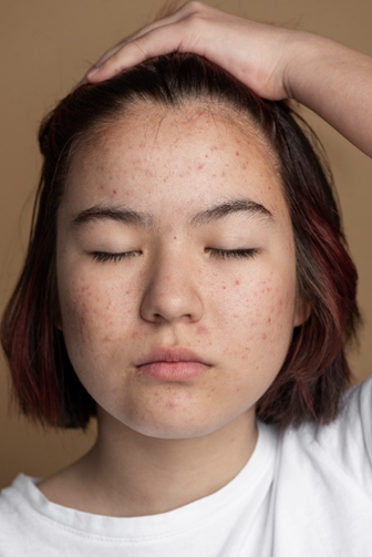 Skin report image